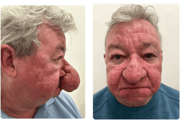 Не міг ні поцілуватися, ні навіть пива нормально випити…