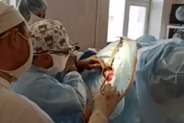 Ковельські медики врятували 40-річну жінку, яка не могла ходити (Фото)