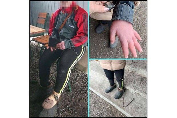 На Кіровоградщині жінка тримала на ланцюгу 17-річну дівчину з інвалідністю