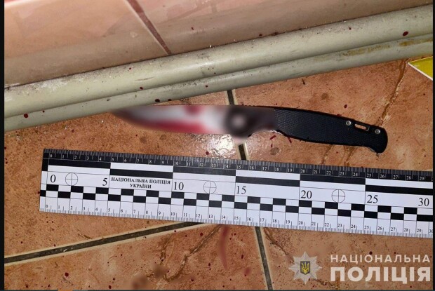 Під час сварки 19-річна дівчина вдарила ножем рідного батька 