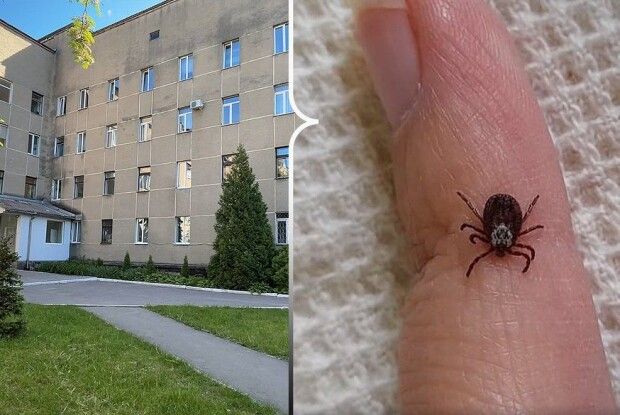 На Рівненщині чоловік потрапив до реанімації через укус кліща