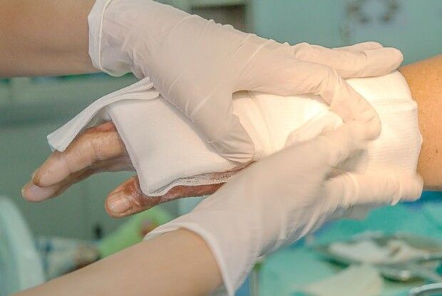 У Луцькому районі необережне поводження з газовим балоном призвело до травм