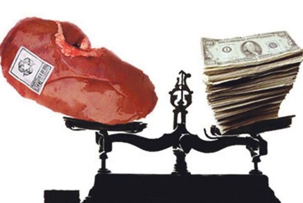 20-річний наречений продав нирку, щоб відсвяткувати весілля