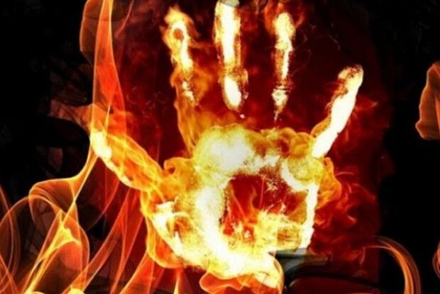 Обгорів до кісток черепа: чоловік всунув голову у грубку з вогнем