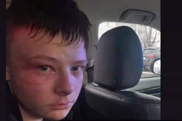 Відоме ім'я 16-річного лучанина, який на переході збив 5 людей (Фото)