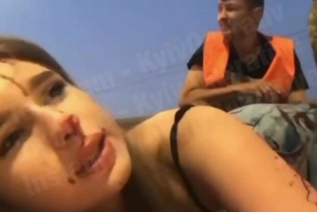 Закривавлена після ДТП дівчина почала одразу записувати контент для інстаграму (Відео)