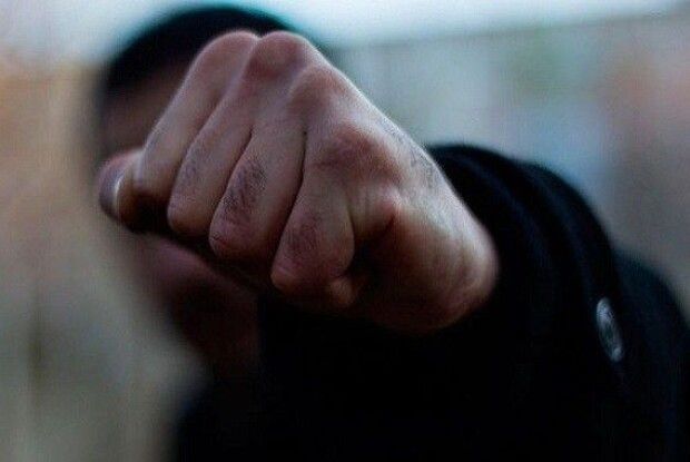 Отримав перелом кісток основи черепа: на Рівненщині молодик побив пенсіонера