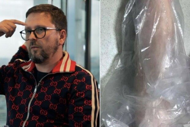 Під офіс партії Шарія підкинули фалоімітатор. За справу взялася поліція