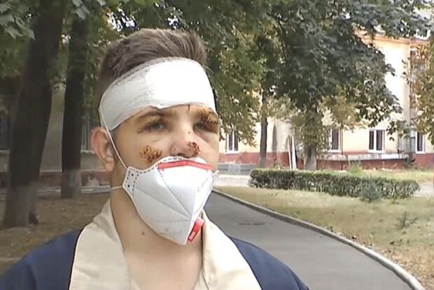 Коли В’ячеслав отямився  в палаючому літаку, почав збивати полум’я з друга…