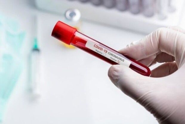 За добу коронавірус забрав життя 8 волинян