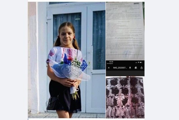 Сім’я атовця з Горохівщини потребує допомоги