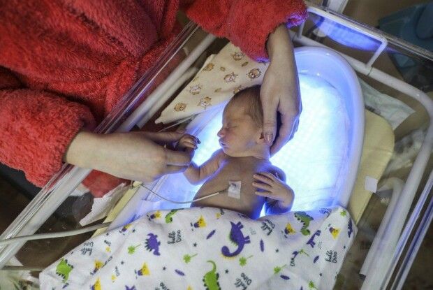 Волинь – серед лідерів, де найбільше передчасно народжених малюків отримали реабілітаційну допомогу