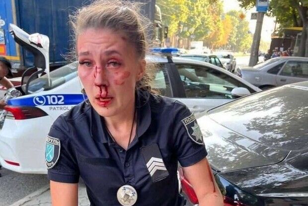 Постраждала поліцейська передала армії зібрані на своє лікування кошти 