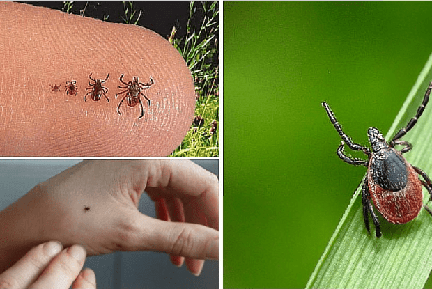 75-річний волинянин потрапив до лікарні після укусу кліща