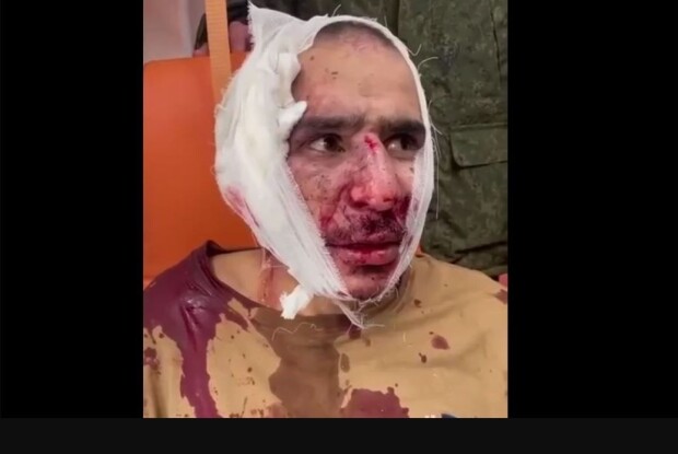 Підозрюваному терористу російські поліцейські відрізали вухо  і змусили його з’їсти