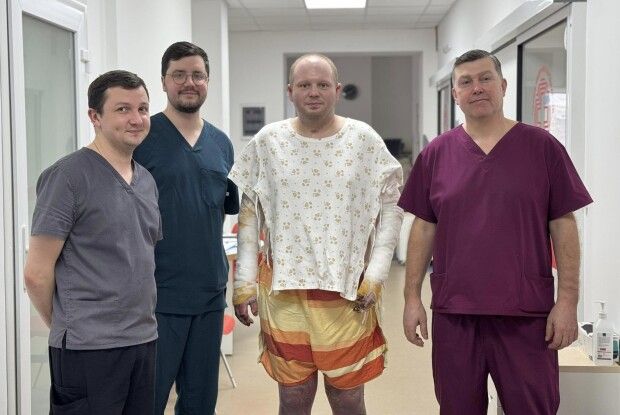Священник Андрій Бойко вижив після опіків 70% тіла