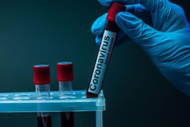 17 хворих і одна смерть: яка ситуація з коронавірусом в Нововолинську
