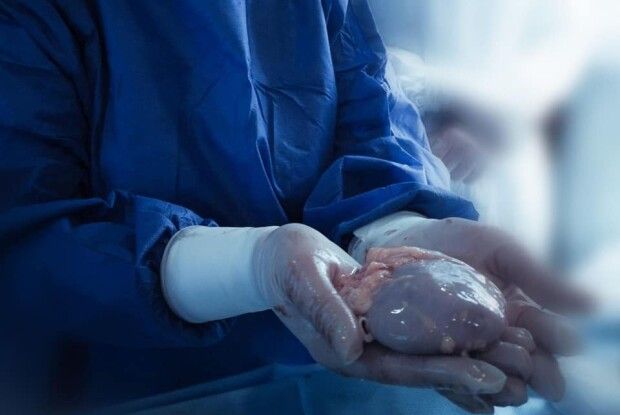 Лікар з Волині ініціював у Львові створення кафедри трансплантології