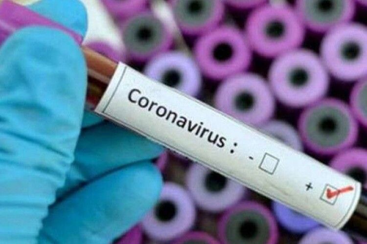 Мама семирічної хворої на коронавірус: «Вдячна кожному, хто не злякався і допомагав»