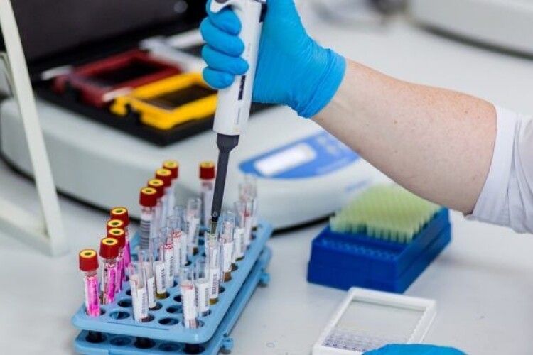 Волинянам радять перевірити імунний статус