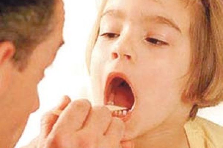 ЛЕГКО КАЗАТИ:  ЗАКРИЙ РОТИК