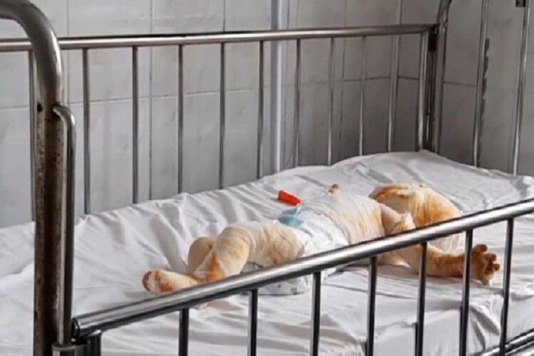 На Рівненщині 3-річний малюк підпалив ковдру 8-місячного брата: 25% тіла немовляти обпечено