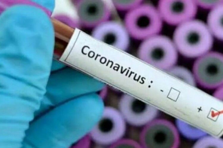 На Ковельщині за добу 13 нових випадків коронавірусу