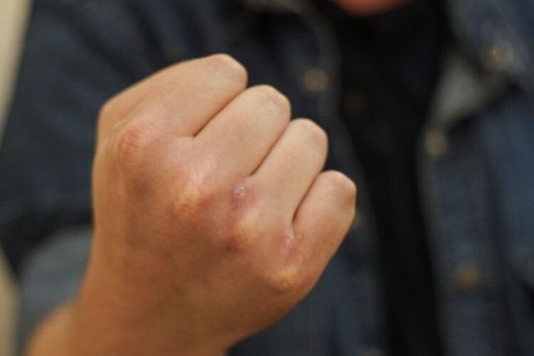 У Нововолинську 16-річний і 19-річний парубки побили та пограбували 13-річного хлопця