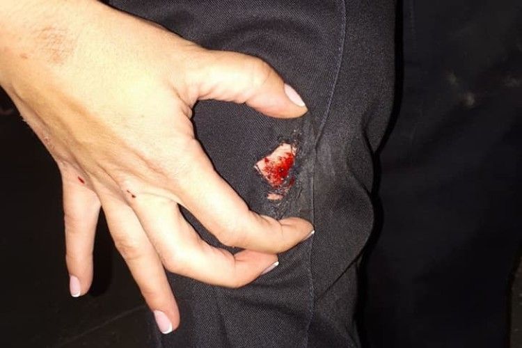 П’яний водій, втікаючи від рівненських поліцейських, скалічив інспекторку
