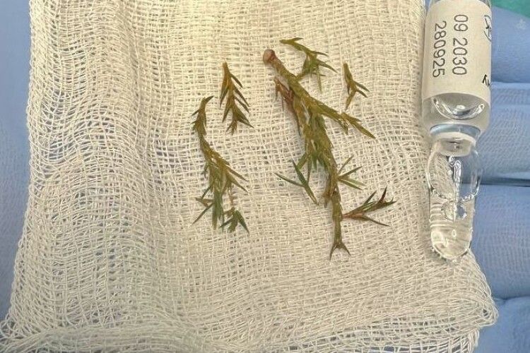 У Львові врятували 8-місячного малюка, який задихався через гілку ялинки