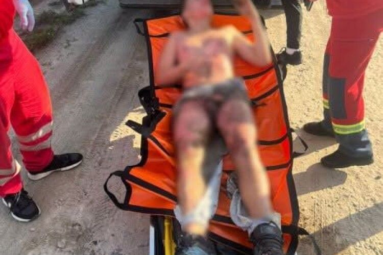 Намагався зробити селфі: у Львові 13-річний хлопець отримав удар струмом на даху поїзда