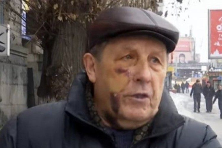 Поліцейських обвинувачують у побитті 81-річного чоловіка