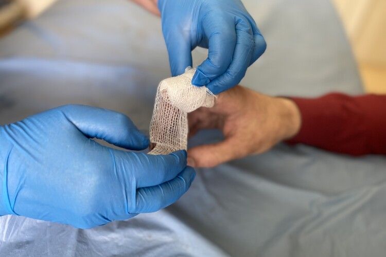 На Волині рятували хлопця з обмороженням пальців