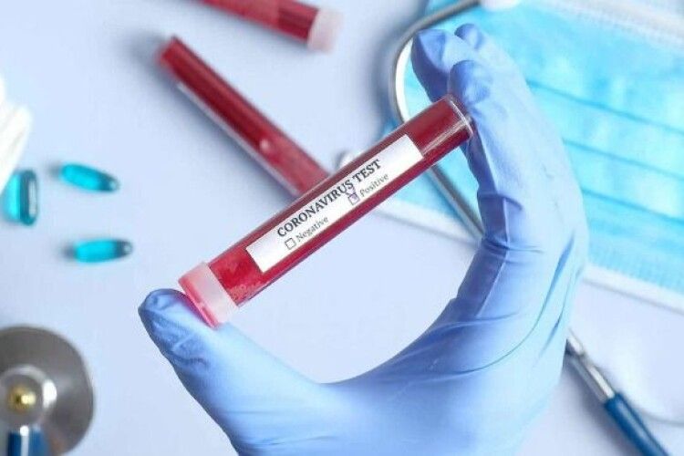 У Нововолинську за добу на коронавірус захворіло 9 людей