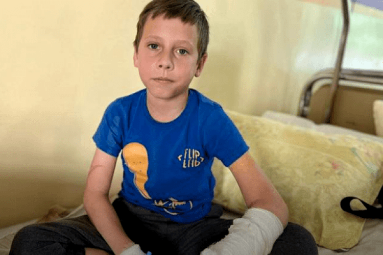 Львівські лікарі прооперували 10-річного хлопчика, який наскрізь пробив руку металевою огорожею (Фото18+)