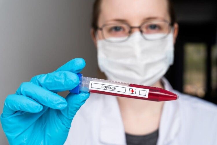 В Україні протягом доби зафіксовано 731 новий випадок коронавірусу