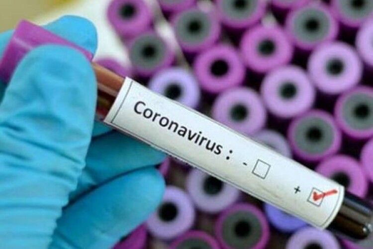 На Волині вже 34 хворих на коронавірус у Луцьку та у 6 районах області 