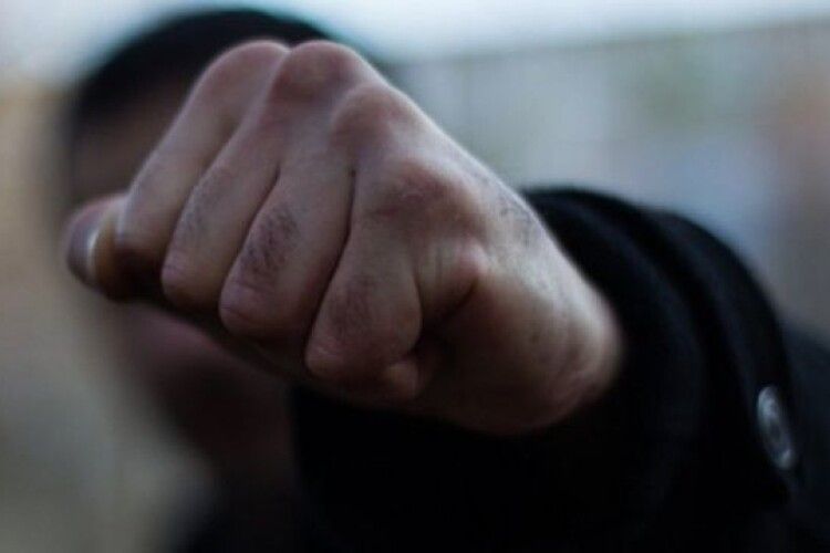 У Луцьку серед білого дня побили й пограбували чоловіка