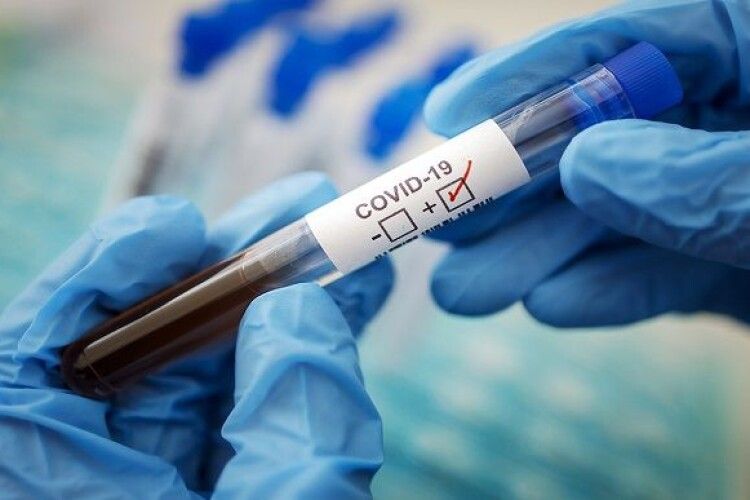 35 інфікованих коронавірусом волинян не можуть самостійно дихати 