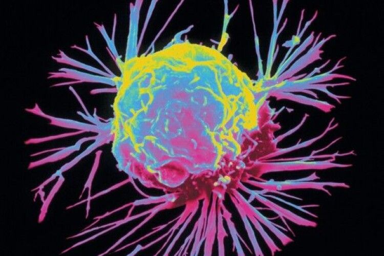 Австралійські вчені виявили нові варіанти мутацій генів, що впливають на розвиток раку
