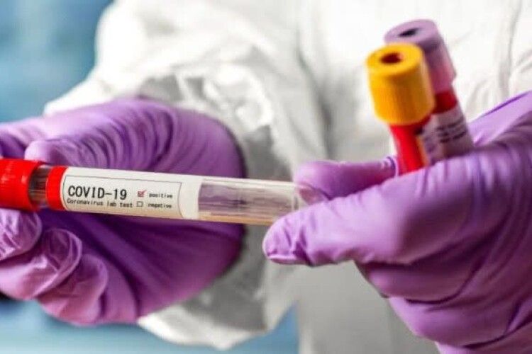 На Рівненщині кількість хворих на коронавірус вже перевищила позначку в 900 осіб