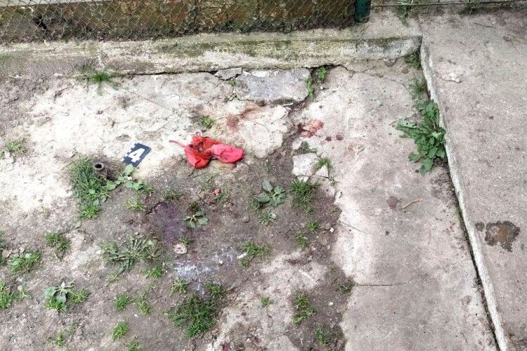 Страшна трагедія на Рівненщині: домашня вівчарка вбила 1,5-місячне немовля