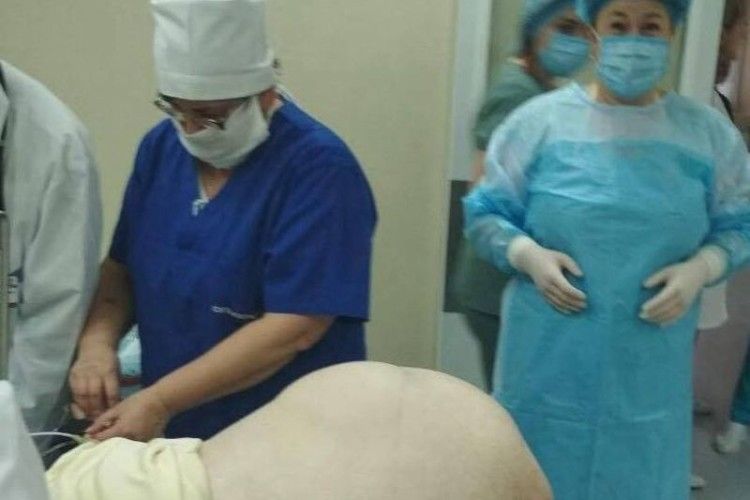 Жінці з Полісся видалили 27-кілограмову пухлину