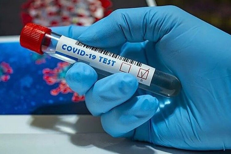 Коронавірус на Волині збавив темпи, але забрав 8 життів: усі цифри на 3 жовтня