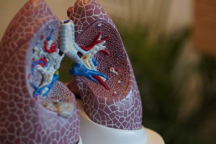Як зберегти здоров’я легень: ефективні та практичні поради сімейної лікарки