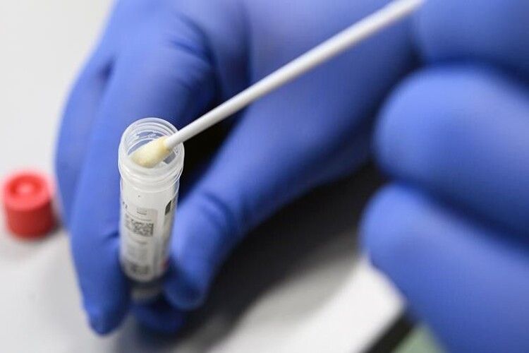 У Луцькому перинатальному почали робити тести на антитіла до коронавірусу