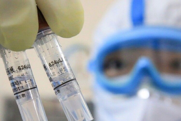 Вперше за тривалий час на Волині не зафіксовано смертей від COVID-19 (виправлено)