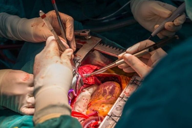 Ковельські медики провели унікальну операцію  на відкритому серці