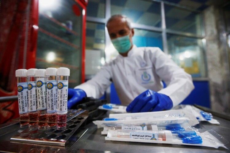 Міністр охорони здоров'я назвав причини різкого зростання кількості хворих на COVID-19
