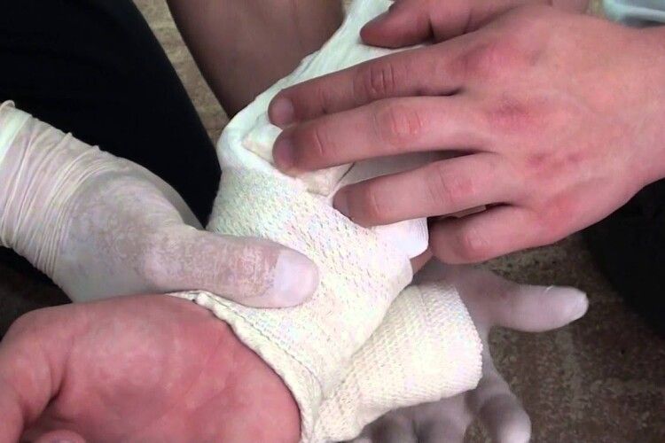 36-річний чоловік після сварки з мамою порізав собі лезом руку в туалеті